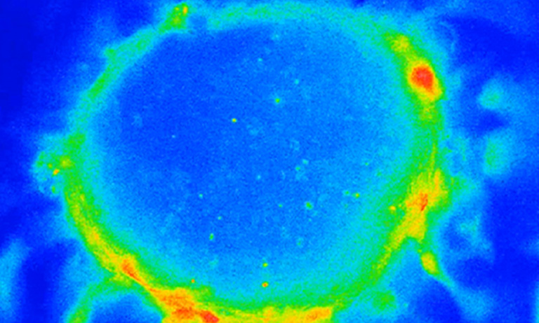 カルシウムイメージング