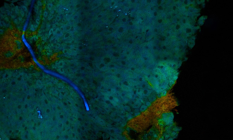 FLIM（蛍光寿命顕微鏡）