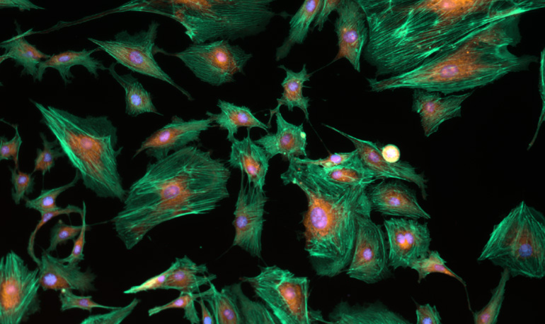 Fluorescence Imaging