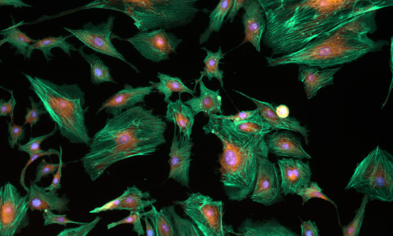 Fluorescence Imaging
