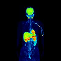 Creation of PET probes for unrevealed biological functions